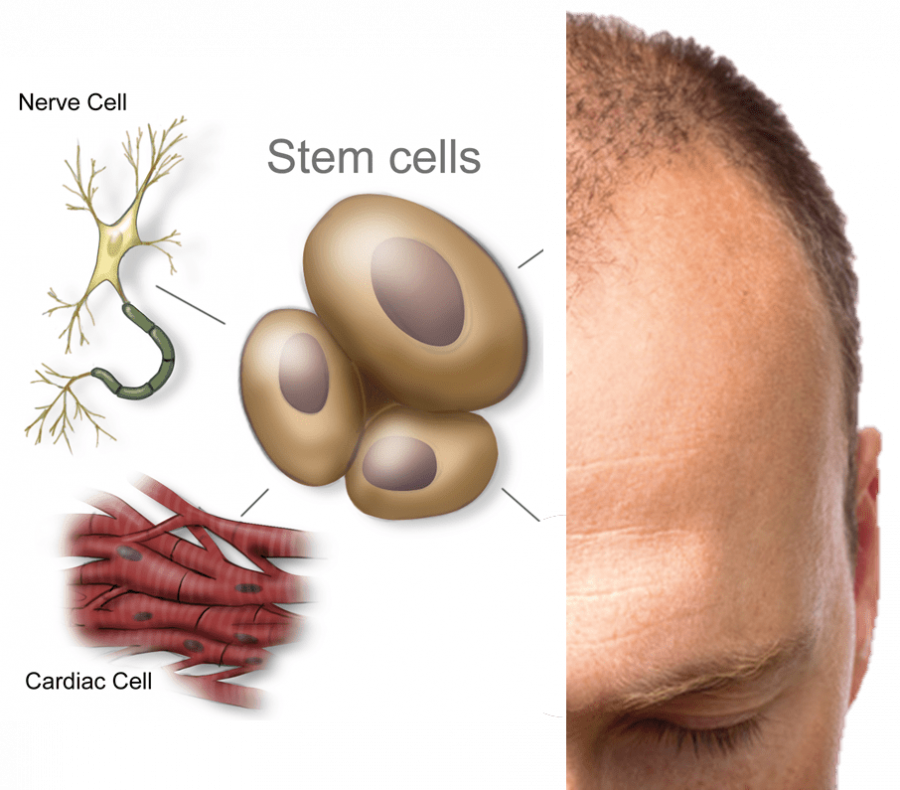 Stem-cells-to-create-hair-regrowth